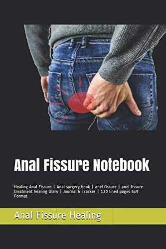 Anal Fissure Notebook: Healing Anal Fissure | Anal surgery book | anel fissure | anel fissure treatment healing Diary | Journal & Tracker | 120 lined pages 6x9 Format